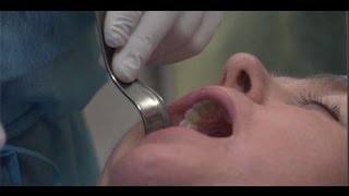 AllOn4 Dental Implants with Oral Surgeon Dr John Wallace [upl. by Faruq]