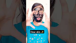 Remove for blackheads✨clearskin viralvideo trending yt ytshortsindia skincaretips [upl. by Enneite343]