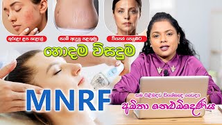 ගැටලු රැසකට උත්තරය MNRF  Skin Specialist [upl. by Hogarth]