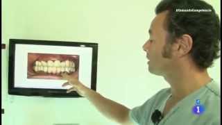 Reportaje  Precio y calidad de implantes dentales  Comando actualidad [upl. by Aymik376]