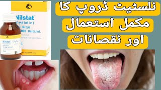 Nilstat Drops Uses  Nilstat Drops Side Effects  Mouth ulcer  Nystatin Uses in UrduHindi [upl. by Showker]