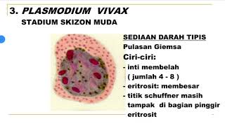 6b Identifikasi Malaria Plasmodium vivax [upl. by Ynalem]