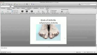 Prevent and Reverse Arthritis with Diet Webinar 2216 [upl. by Endys258]