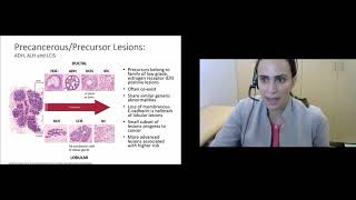 Breast Pathology Why Do Some Lesions Require Surgery and Others Do Not [upl. by Thissa]