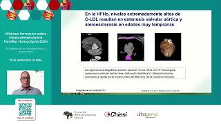 Webinar educativo sobre Hipercolesterolemia Familiar Homocigota 2024 [upl. by Suoivatnom897]