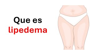 ¿Que es lipedema [upl. by Ameyn]