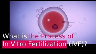 IVF PROCESS HELPFUL STEP BY STEP GUIDE In Vitro Fertilization [upl. by Calista]