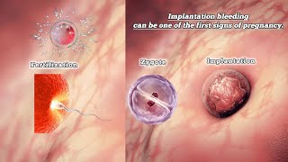 Fertilization and Implantation  Implantation Bleeding can be one of The First Signs of Pregnancy [upl. by Ahsieyn]