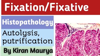 Fixationfixative histopathology Hindi and english by Kiran maurya  part 1 [upl. by Ataynik]