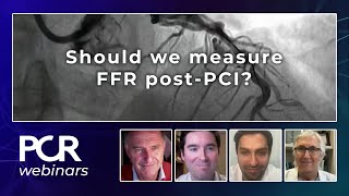 Should we measure FFR postPCI  Webinar [upl. by Nnanaej]