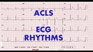 ACLS  ECG rhythm recognition amp management Part 1 [upl. by Abas]