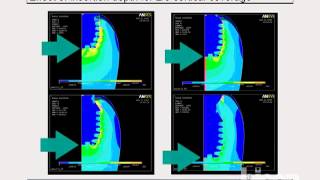 Finite Element Analysis of Various Implant Designs Including Bicons 60mm x 57mm Implant [upl. by Demmahom]