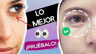 QUITA OJERAS Y BOLSAS 👁✅ EN 1 SEMANA [upl. by Alika708]