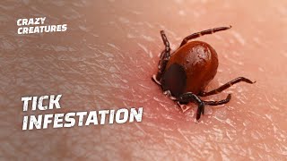 WARNING The Most Horrific Tick Infestations [upl. by Ko]