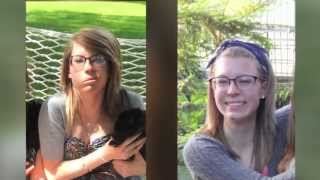 Bells palsy One Loyola patients story [upl. by Pennebaker]