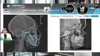 Ceph assistant para cefalometría con IA de cedirama [upl. by Aynnek172]