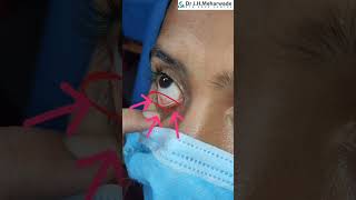 How to apply eye ointment  Simple and Correct method [upl. by Eissahc]