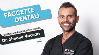 FACCETTE DENTALI cosa sono e a cosa servono [upl. by Anirbed325]