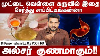 உங்க மலம் இந்த கலரில் இருந்தால் அல்சர் இருக்கு  Ulcer treatment at home  DrKPaneer selvam [upl. by Emmeline678]