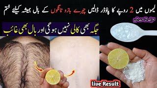 Permanent hair removal at home  Best Hair Removal Cream  Painless hair removal  DIY Remedies [upl. by Aniloj480]