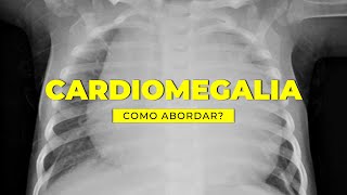 Todo aumento de área cardíaca é cardiomegalia [upl. by Mad]