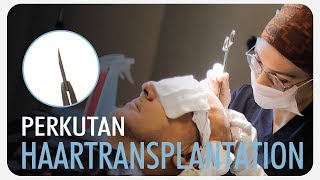 Haartransplantation mit Perkutan Technik  Wie funktioniert es [upl. by Solenne492]