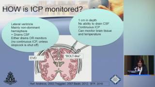 Mastering ICP Management [upl. by Ihab]