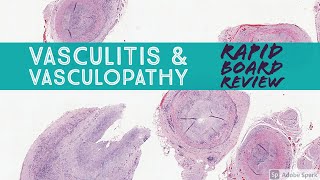 Dermpath Board Review Vasculitis amp Vasculopathy Dermpath Dermatology Pathology [upl. by Oralia]