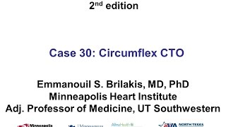 Case 30 Manual of CTO Interventions  Circumflex CTO with ambiguous proximal cap [upl. by Ahsekan]