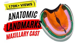 Lets Learn Anatomic landmarks in maxillary cast [upl. by Michaele967]