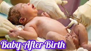 Newborn baby First 5 minutes After Birth  Baby immediately After c section birth care [upl. by Samalla]