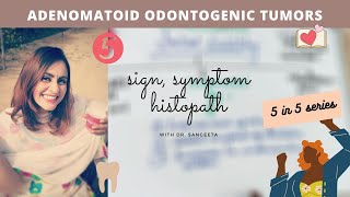 adenomatoid odontogenic tumor [upl. by Shiekh]