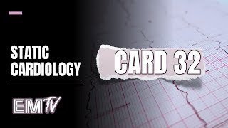 Static Cardiology CARD 32 [upl. by Ailadi]