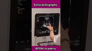 Echocardiography  an ultra sound for heart ❤️  Test and procedure [upl. by Samella]