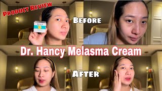 Dr Hancy Melasma Cream Product Review vlog vlog3 skincare skincarereview skincareproductreview [upl. by Adnertal474]