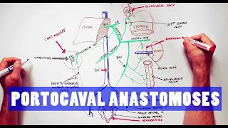 Portocaval Anastomoses  ANATOMY Tutorial [upl. by Mcquade565]