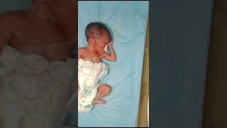 obed This newborn baby Hypotonia lack of healthy mother this newborn baby very thin body [upl. by Larok]