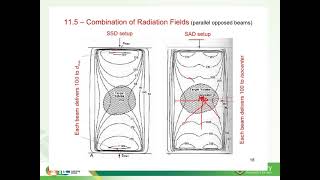 SSD vs SAD Treatment Techniques in Radiation Therapy [upl. by Arihsat]