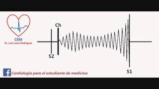 Soplo de la estenosis mitral [upl. by Aronle]