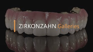 Prettau® 4 Anterior® zirconia on Sintermetall  ZirkonzahnGalleries [upl. by Imailiv]