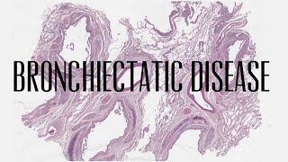 4 Bronchiectatic disease [upl. by Virnelli993]