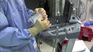 Sterile Sheath for Ultrasound Guided Procedure Single Operator Technique [upl. by Bentley]