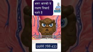 Fissure Treatment  fissure treatment in hindi  fissure treatment at home hindi shorts ytshorts [upl. by Niala]