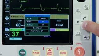 X Series® Pacing English [upl. by Airdnaed80]