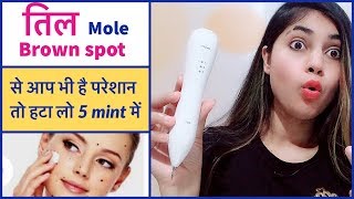 How to Remove mole on face अनचाहे तिलों को हटाए मिनटों मेंSuhaiStyleTips [upl. by Airelav]