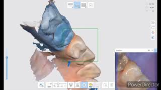 Using Medit i700 Intraoral Scanner to show blocking of one area and cut and rescan other areas [upl. by Eskil]