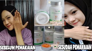 REVIEW PENGALAMAN MINUM VITALINE SOFTGELS TIENS PEMUTIH KULIT [upl. by Ylrebmi419]