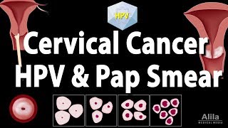 Cervical Cancer HPV and Pap Test Animation [upl. by Amara]