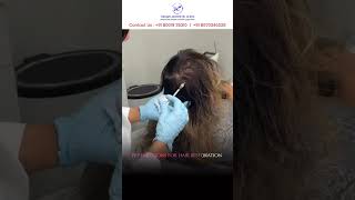 PRP Hair Treatment  RegainAestheticClinics HairRestoration PRPTreatment [upl. by Appilihp]