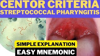 Centor Criteria for Group A Streptococcal Pharyngitis  Easy Mnemonic  Simple Explanation [upl. by Zipporah]